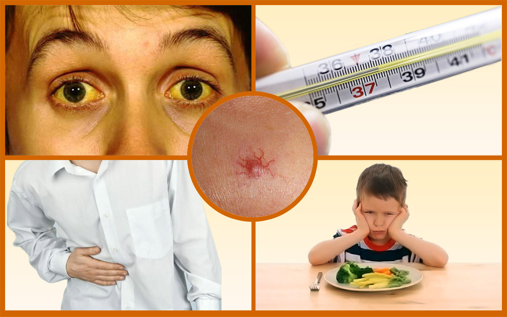 hepatitis 2